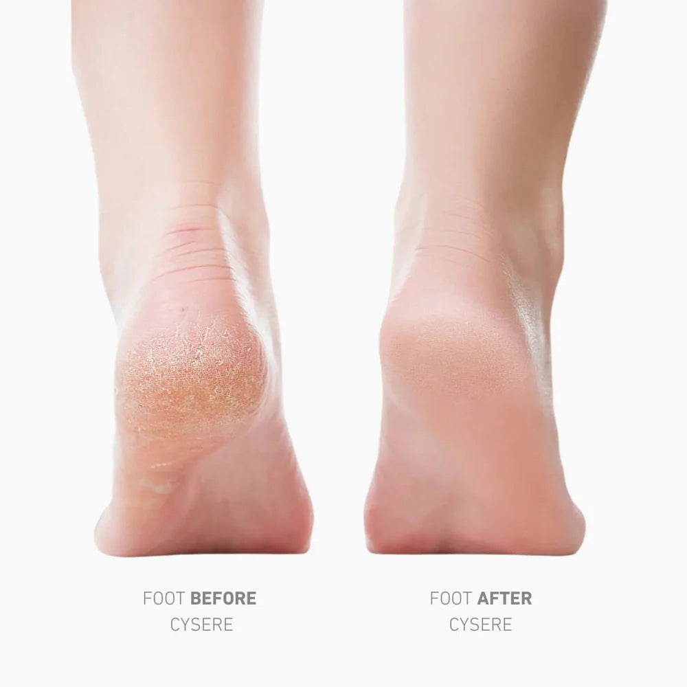 Electric Foot File